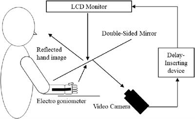 Neural Mechanism of Altered Limb Perceptions Caused by Temporal Sensorimotor Incongruence